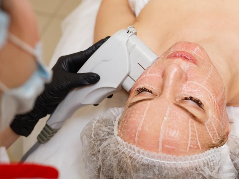 Ultrassom Facial