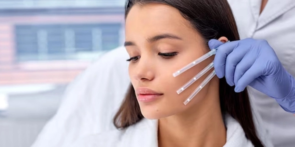 img-trat-bioestimulador-02