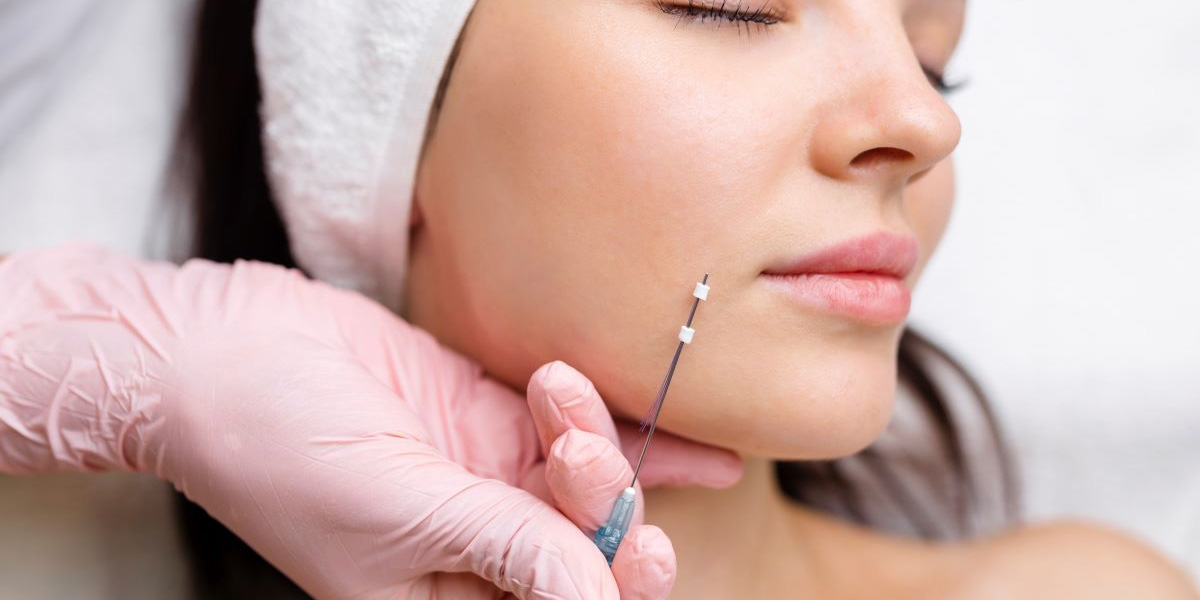 img-trat-fios-pdo-02