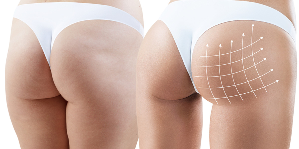 img-trat-harmonizacao-02