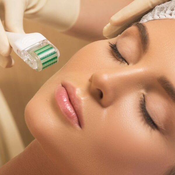 img-trat-microagulhamento-01