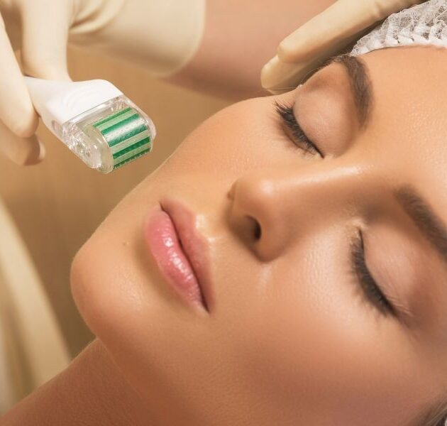 img-trat-microagulhamento-01