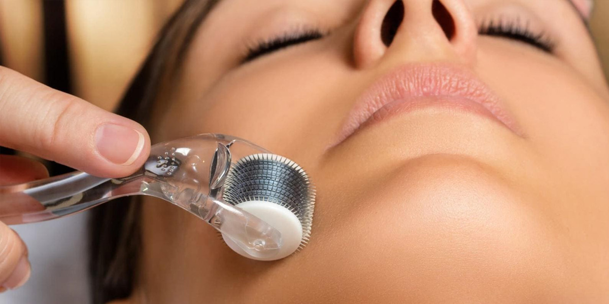 img-trat-microagulhamento-02