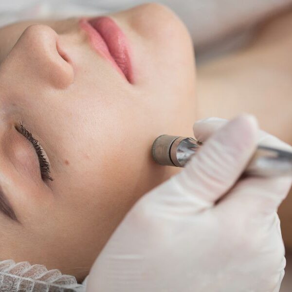 img-trat-peeling-diamante-01