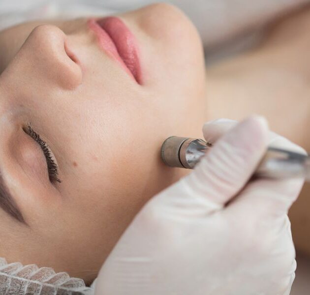 img-trat-peeling-diamante-01