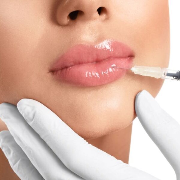 img-trat-preenchimento-labial-01