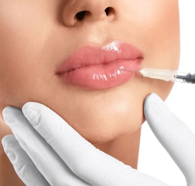 img-trat-preenchimento-labial-01