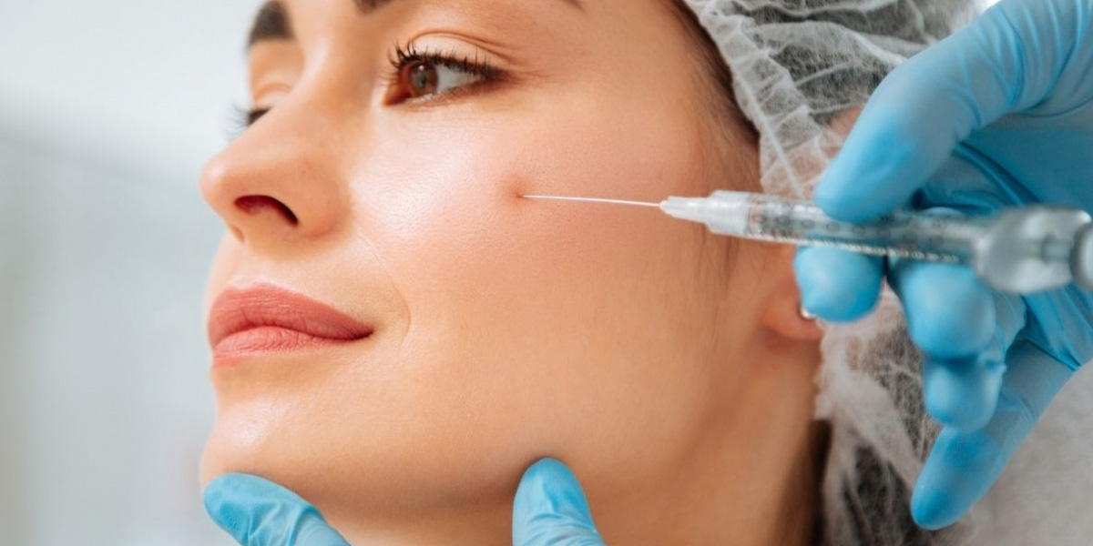 img-trat-preenchimento-malar-02