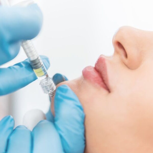 img-trat-preenchimento-mento-01