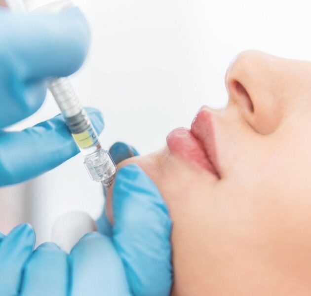 img-trat-preenchimento-mento-01