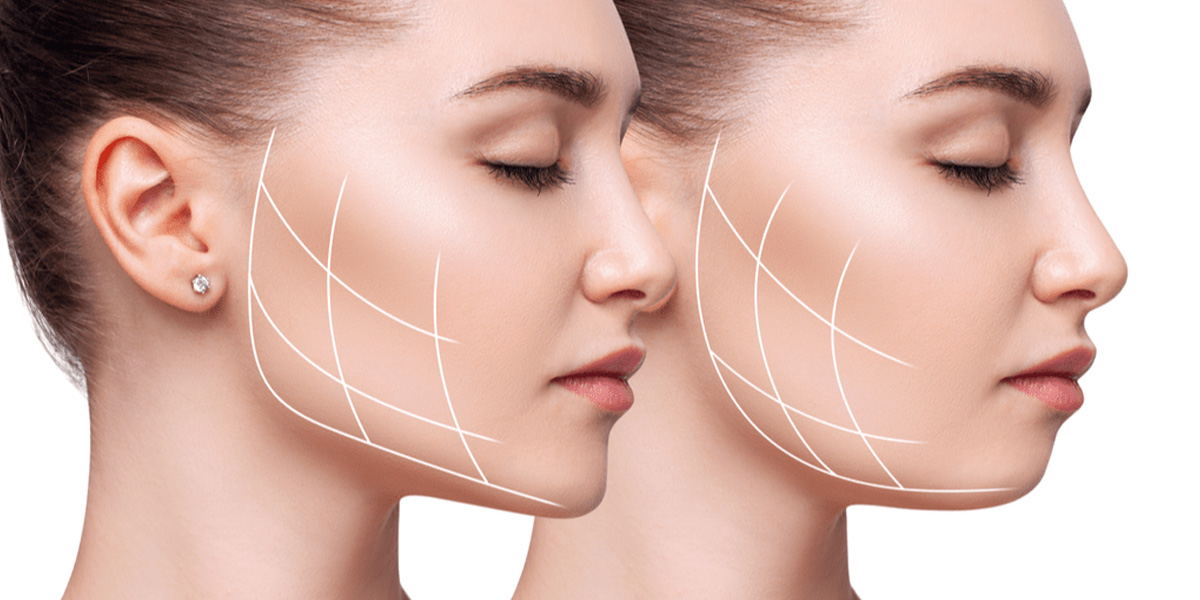 img-trat-preenchimento-mento-02