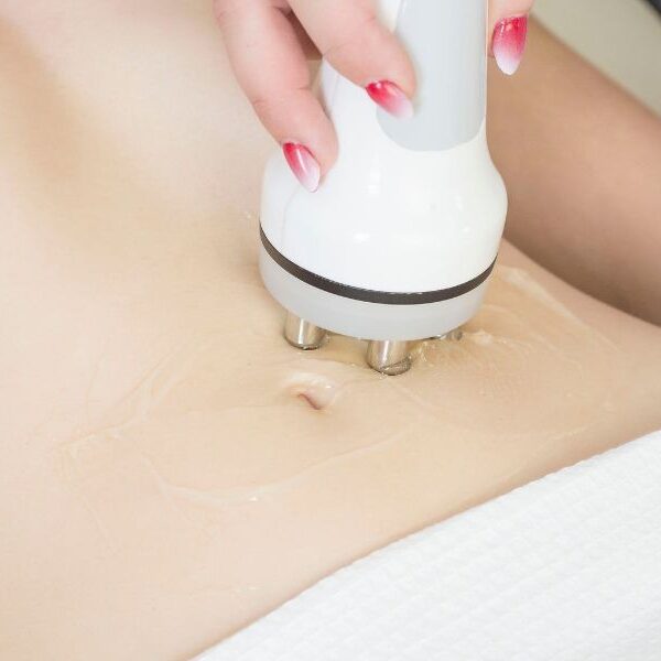 img-trat-radiofrequencia2-01