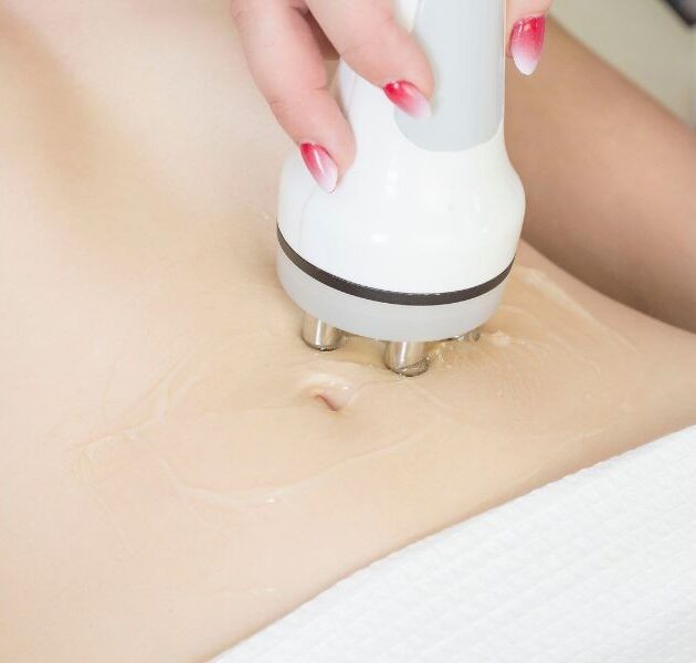 img-trat-radiofrequencia2-01