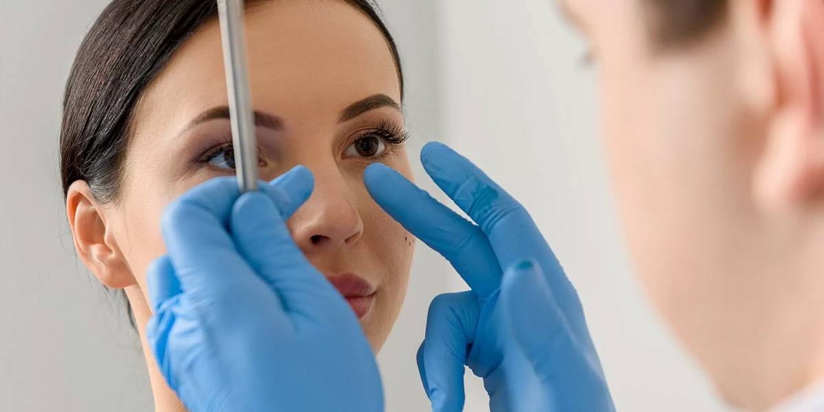 img-trat-rinomodelacao-02