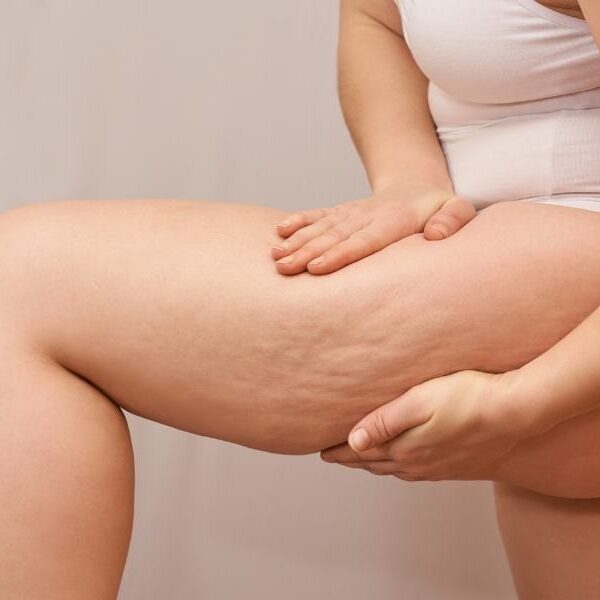 img-trat-subcisao-01