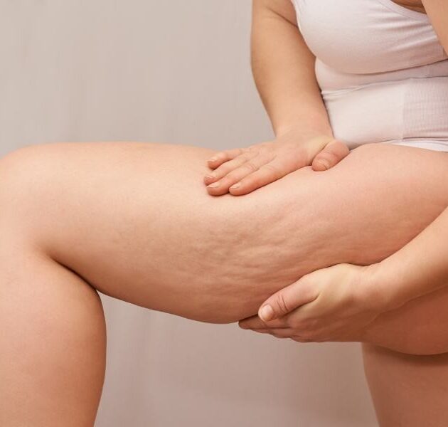 img-trat-subcisao-01